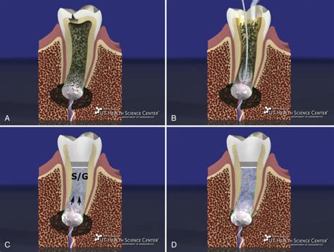  Dentin: Revolutionizing Regenerative Dentistry and Customized Bone Replacements?