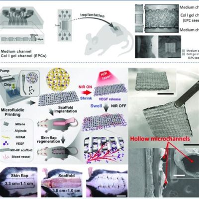  Polycaprolactone: Revolutionizing Regenerative Medicine and Implantable Devices?